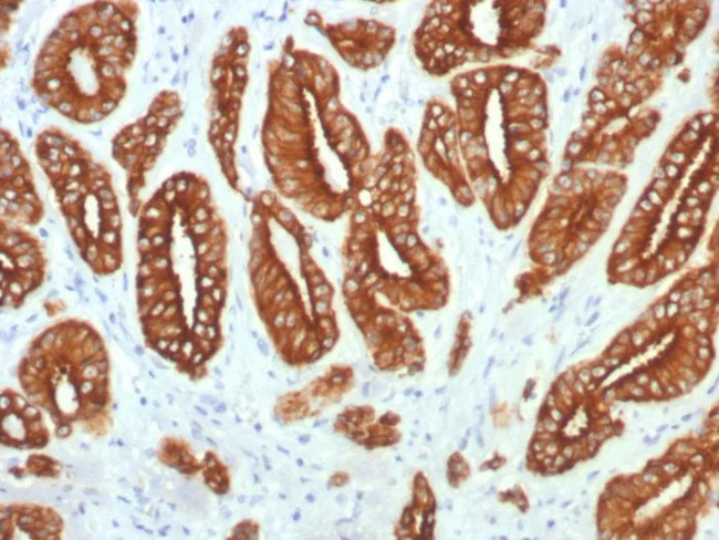 Cytokeratin, Type I (Epithelial Marker) Antibody in Immunohistochemistry (Paraffin) (IHC (P))