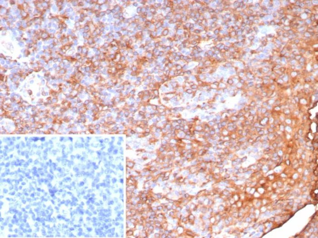 Pan-HLA-II (DP, DQ, DR) Antibody in Immunohistochemistry (Paraffin) (IHC (P))