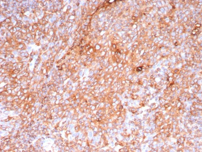 Pan-HLA-II (DP, DQ, DR) Antibody in Immunohistochemistry (Paraffin) (IHC (P))