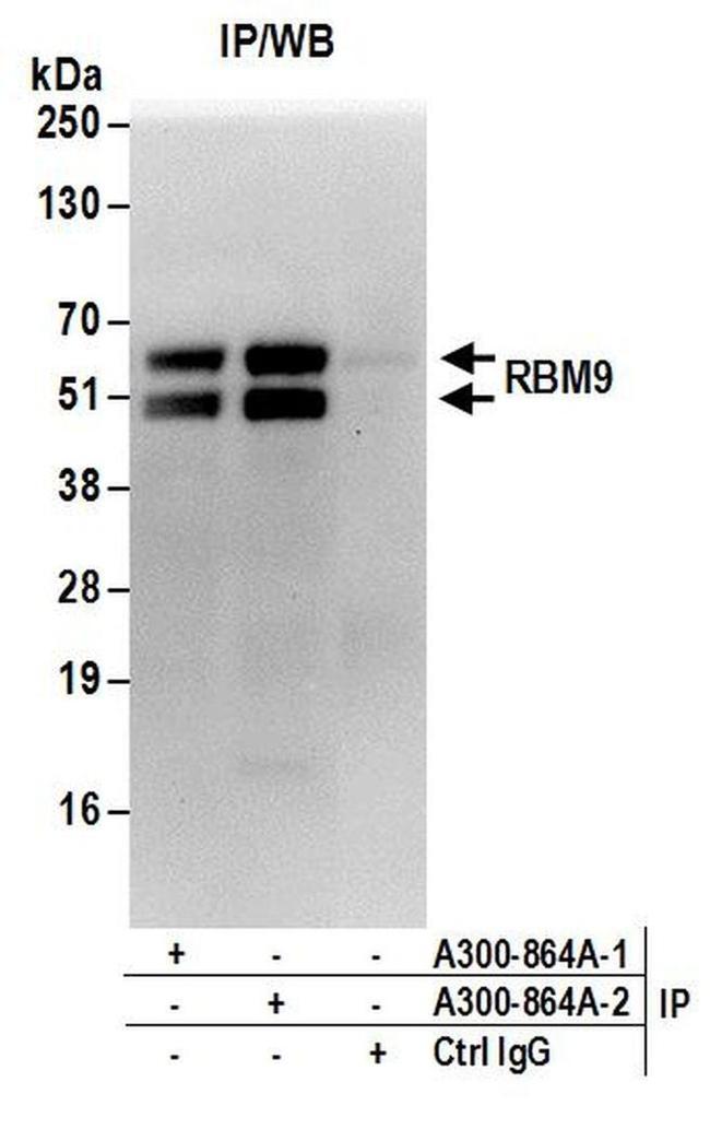 RBM9 Antibody in Western Blot (WB)