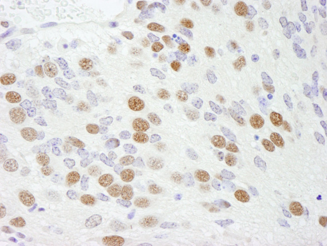 RBM9 Antibody in Immunohistochemistry (IHC)