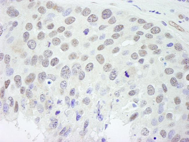 RBM9 Antibody in Immunohistochemistry (IHC)