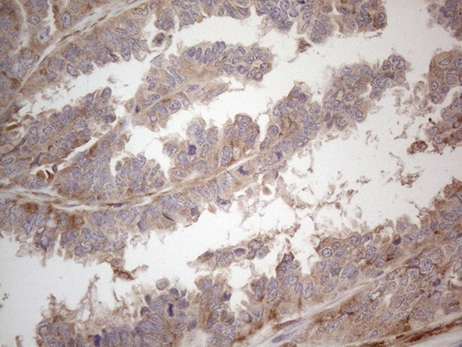 RBMS1 Antibody in Immunohistochemistry (Paraffin) (IHC (P))