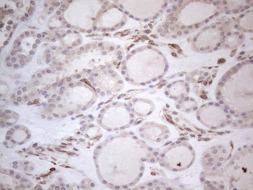 RBMS1 Antibody in Immunohistochemistry (Paraffin) (IHC (P))