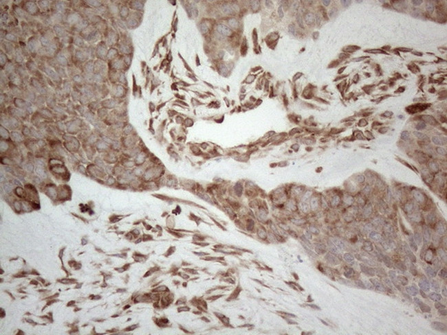 RBMS1 Antibody in Immunohistochemistry (Paraffin) (IHC (P))