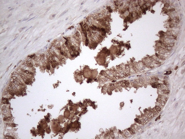 RBMS1 Antibody in Immunohistochemistry (Paraffin) (IHC (P))