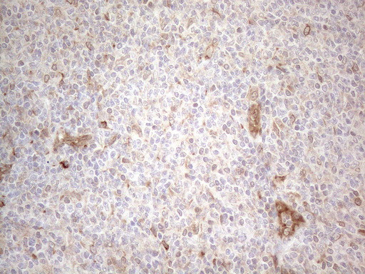 RBMS1 Antibody in Immunohistochemistry (Paraffin) (IHC (P))