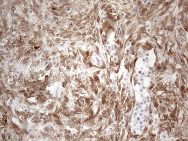 RBMS1 Antibody in Immunohistochemistry (Paraffin) (IHC (P))