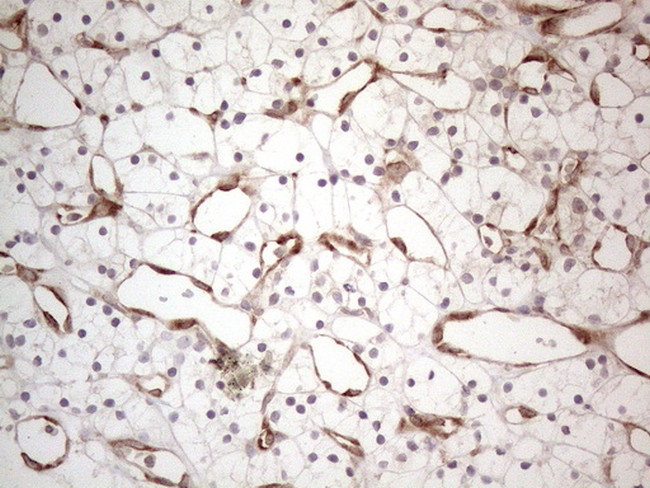 RBMS1 Antibody in Immunohistochemistry (Paraffin) (IHC (P))