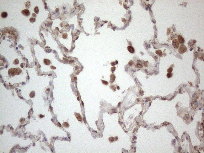 RBMS1 Antibody in Immunohistochemistry (Paraffin) (IHC (P))