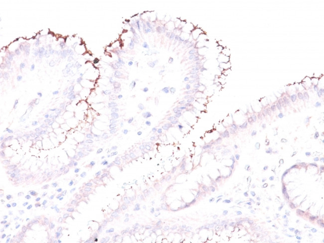 Helicobacter Pylori Antibody in Immunohistochemistry (Paraffin) (IHC (P))