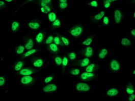 RBP1 Antibody in Immunocytochemistry (ICC/IF)