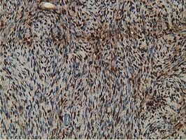 RBP1 Antibody in Immunohistochemistry (Paraffin) (IHC (P))