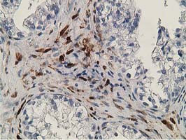 RBP1 Antibody in Immunohistochemistry (Paraffin) (IHC (P))