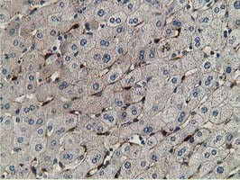 RBP1 Antibody in Immunohistochemistry (Paraffin) (IHC (P))