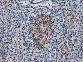 RBP1 Antibody in Immunohistochemistry (Paraffin) (IHC (P))