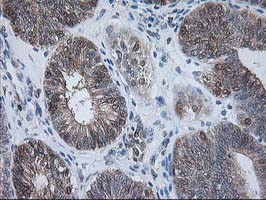 RBP1 Antibody in Immunohistochemistry (Paraffin) (IHC (P))