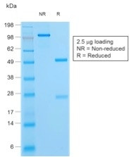 HSV1 (Herpes Simplex Virus Type I) Antibody in SDS-PAGE (SDS-PAGE)