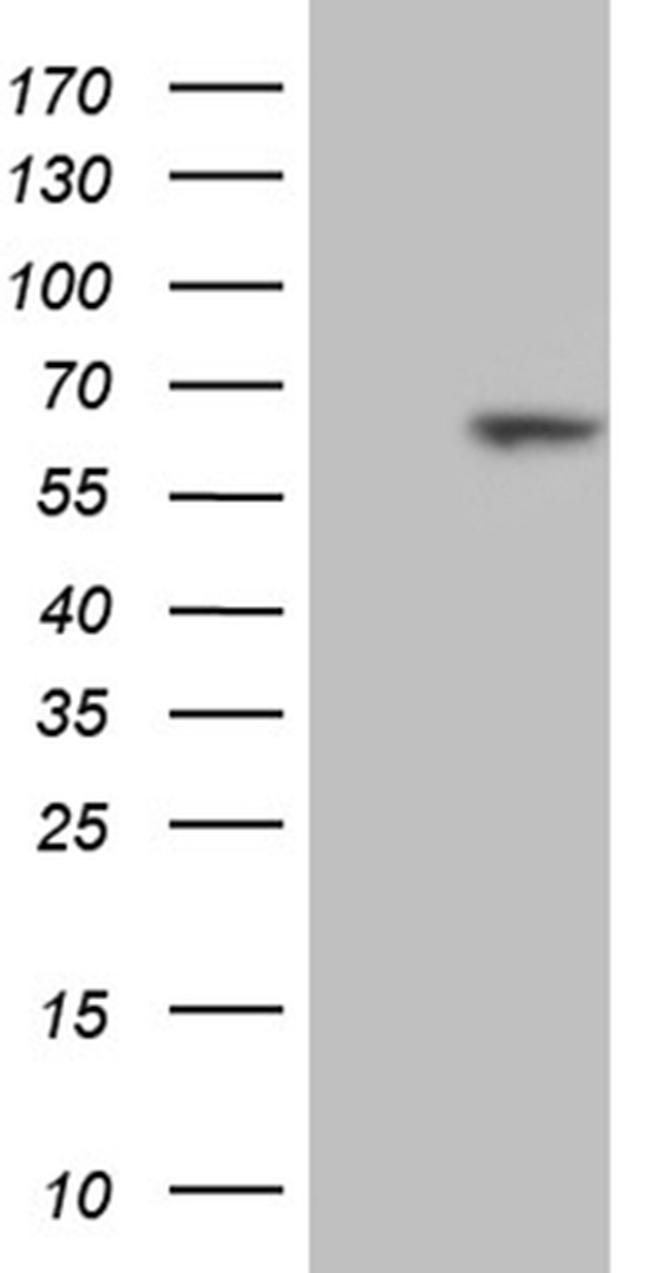 RBPJ Antibody in Western Blot (WB)