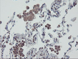 RBPMS Antibody in Immunohistochemistry (Paraffin) (IHC (P))