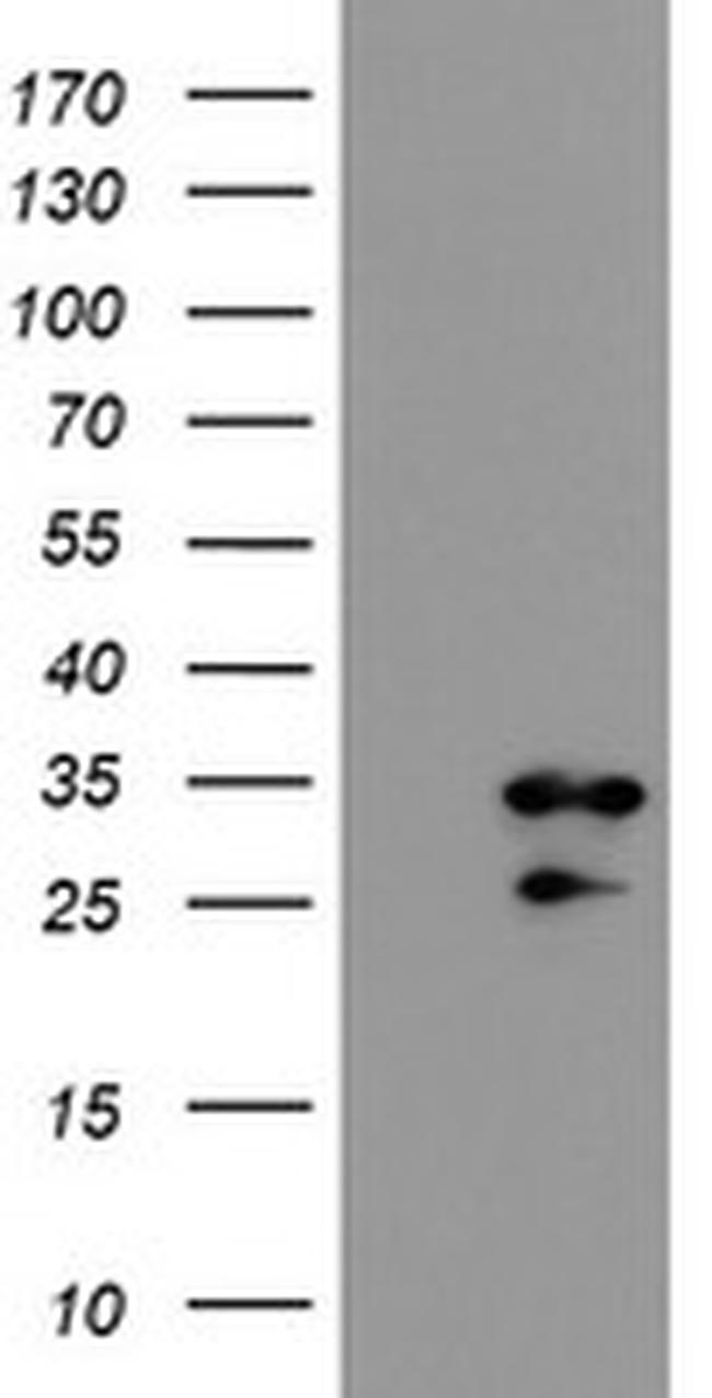 RBPMS Antibody in Western Blot (WB)