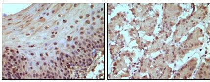 Rb Antibody in Immunohistochemistry (Paraffin) (IHC (P))