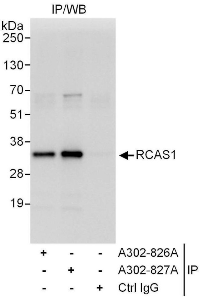 RCAS1 Antibody in Immunoprecipitation (IP)