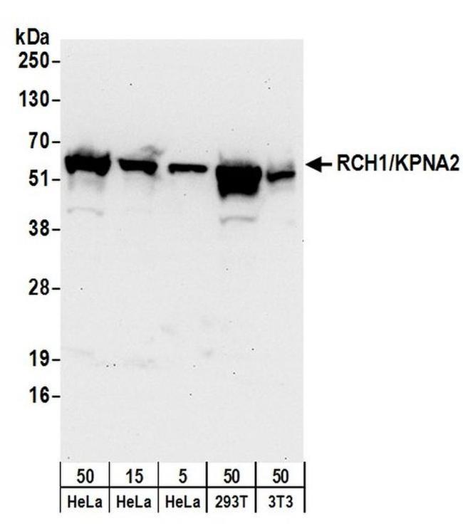 RCH1/KPNA2 Antibody in Western Blot (WB)