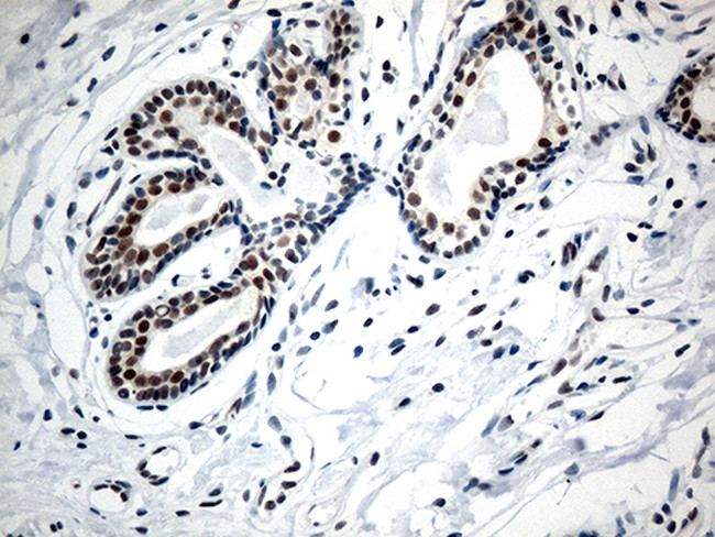 RCOR1 Antibody in Immunohistochemistry (Paraffin) (IHC (P))