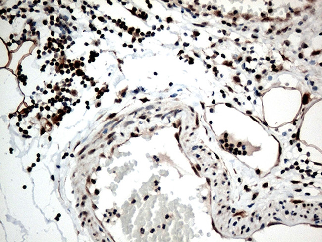 RCOR1 Antibody in Immunohistochemistry (Paraffin) (IHC (P))