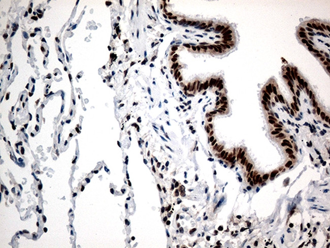 RCOR1 Antibody in Immunohistochemistry (Paraffin) (IHC (P))