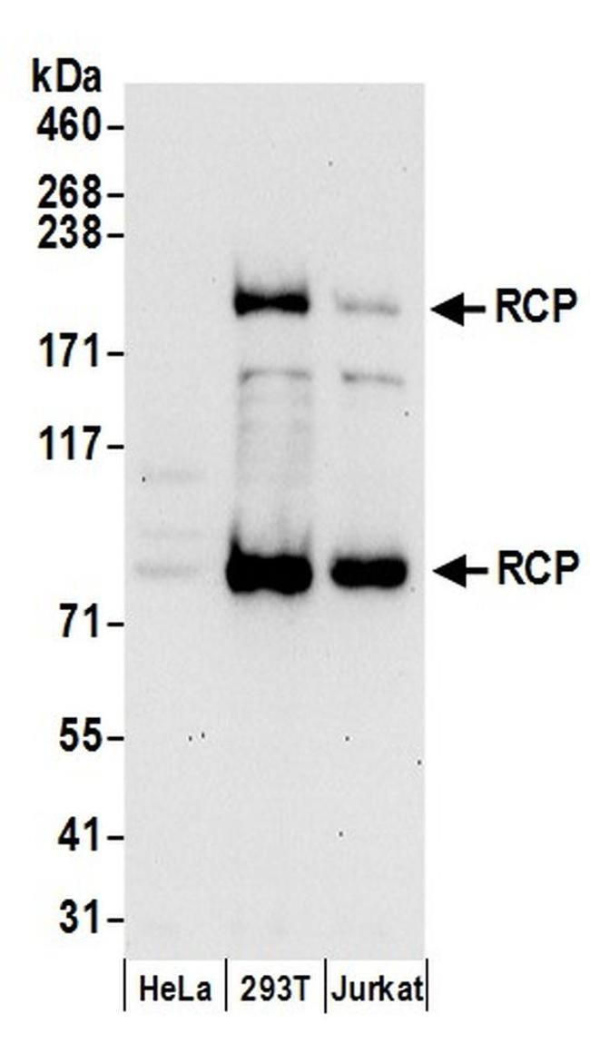 RCP Antibody in Western Blot (WB)