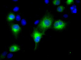 RDH11 Antibody in Immunocytochemistry (ICC/IF)