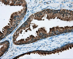 RDH11 Antibody in Immunohistochemistry (Paraffin) (IHC (P))