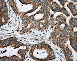 RDH11 Antibody in Immunohistochemistry (Paraffin) (IHC (P))