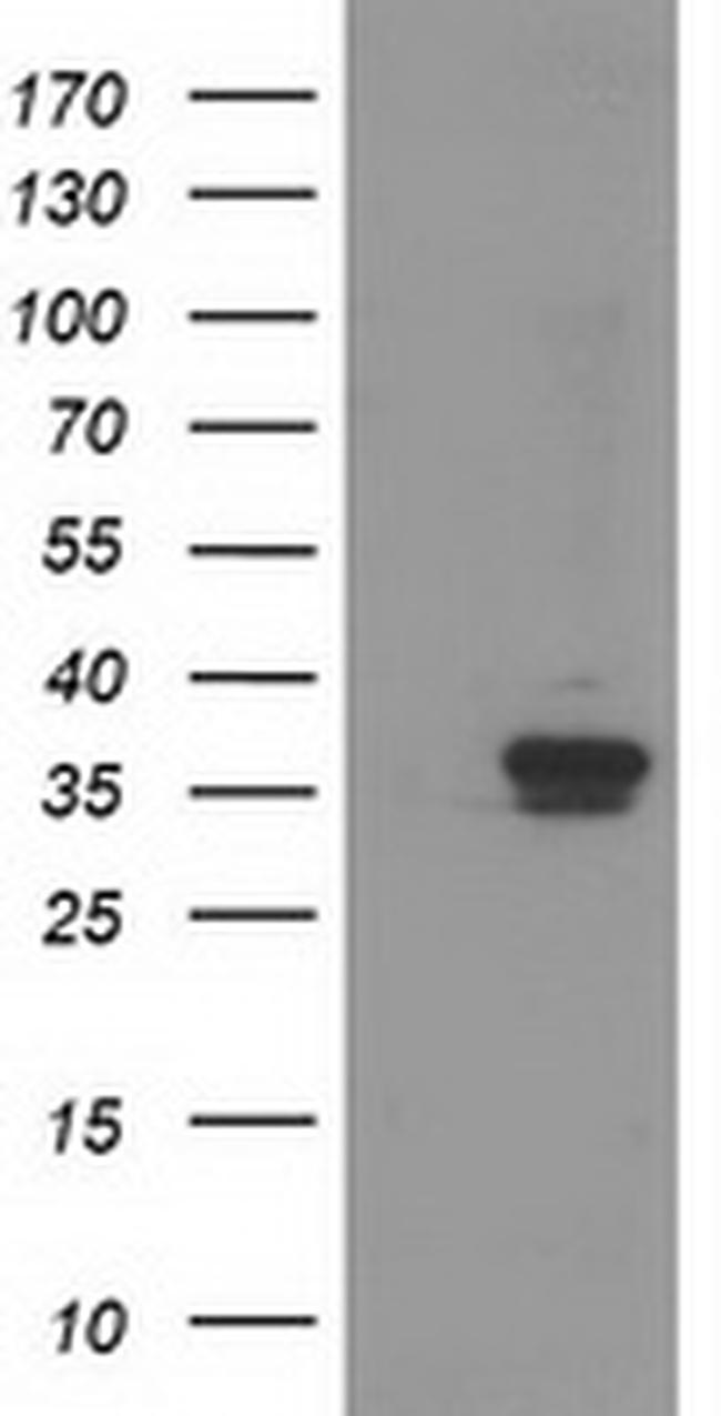 RDH14 Antibody in Western Blot (WB)
