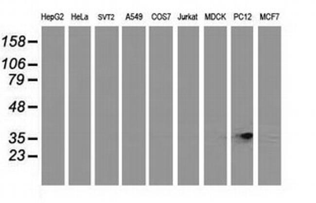 RDH14 Antibody in Western Blot (WB)