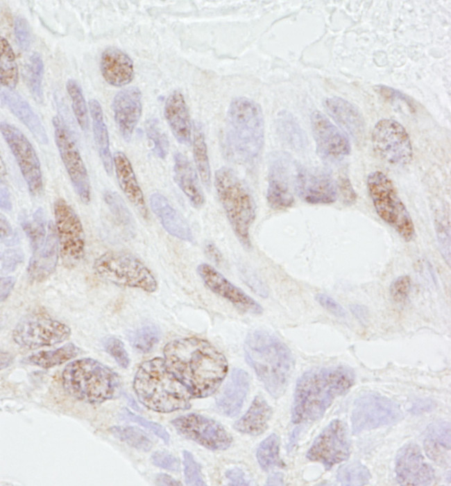 REA Antibody in Immunohistochemistry (IHC)