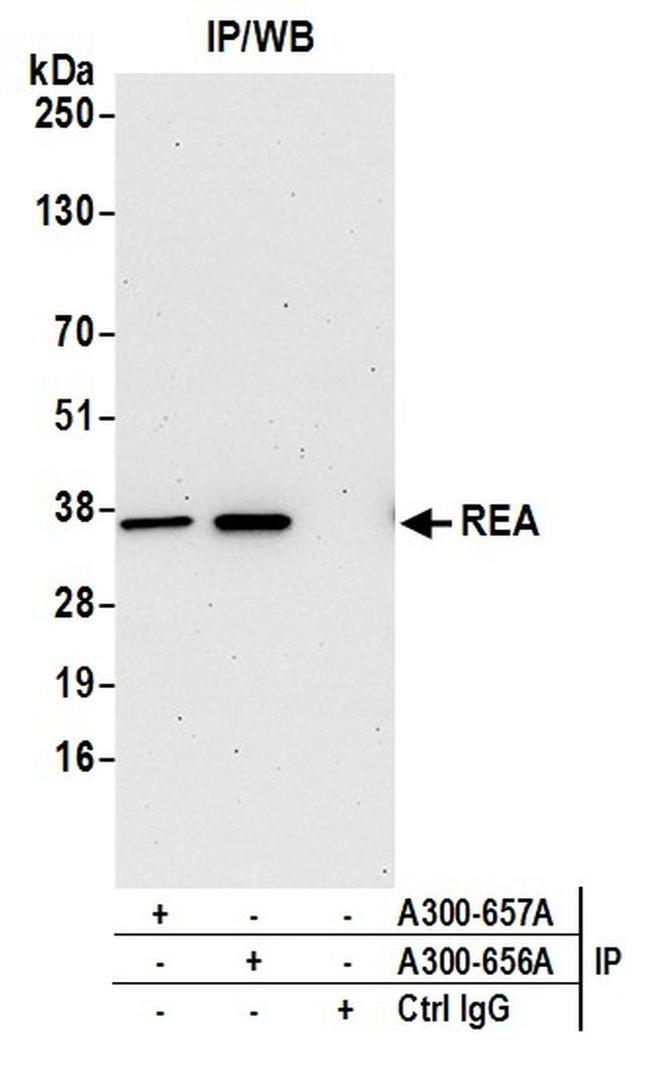 REA Antibody in Western Blot (WB)