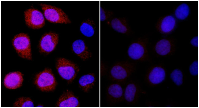 REDD1 Antibody in Immunocytochemistry (ICC/IF)