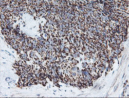 REEP2 Antibody in Immunohistochemistry (Paraffin) (IHC (P))