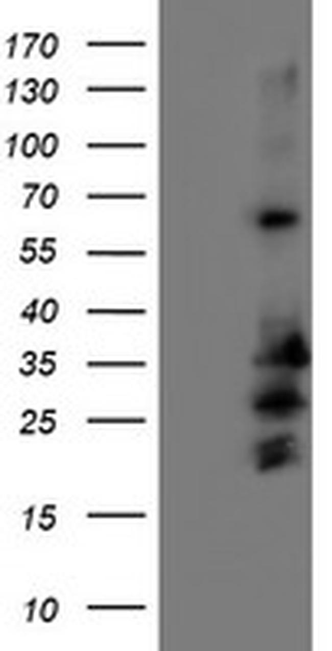 REEP2 Antibody in Western Blot (WB)