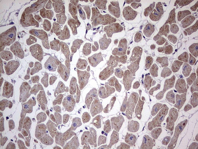 RELA Antibody in Immunohistochemistry (Paraffin) (IHC (P))