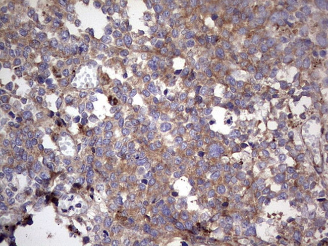 RELA Antibody in Immunohistochemistry (Paraffin) (IHC (P))