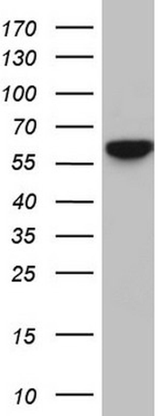 RELA Antibody in Western Blot (WB)