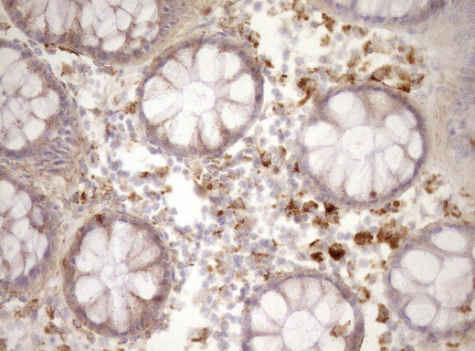 REN Antibody in Immunohistochemistry (Paraffin) (IHC (P))