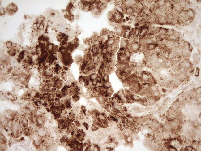 REN Antibody in Immunohistochemistry (Paraffin) (IHC (P))