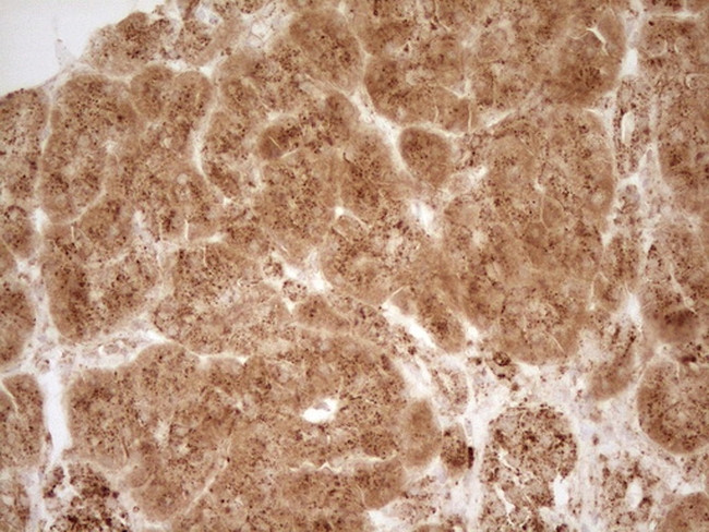 REN Antibody in Immunohistochemistry (Paraffin) (IHC (P))