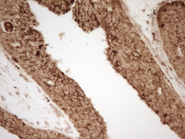 REN Antibody in Immunohistochemistry (Paraffin) (IHC (P))