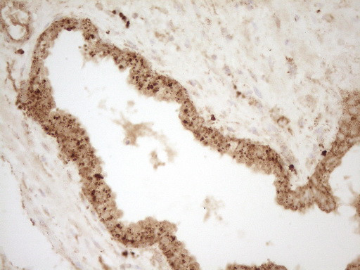 REN Antibody in Immunohistochemistry (Paraffin) (IHC (P))